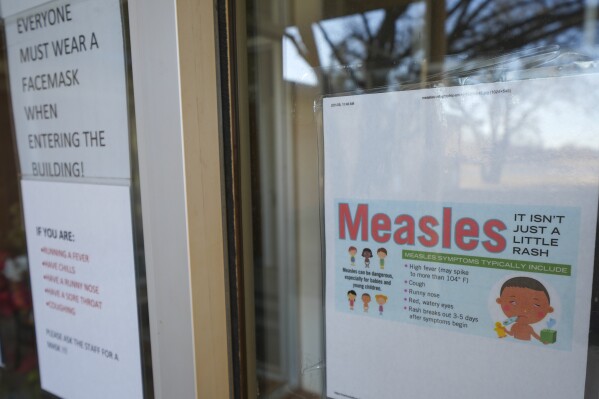 Texas Measles Outbreak: Tragic Child Fatality as Cases Surge to 130