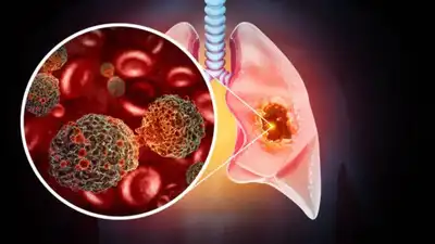 Medical researchers examining laboratory samples during new cancer research studies.