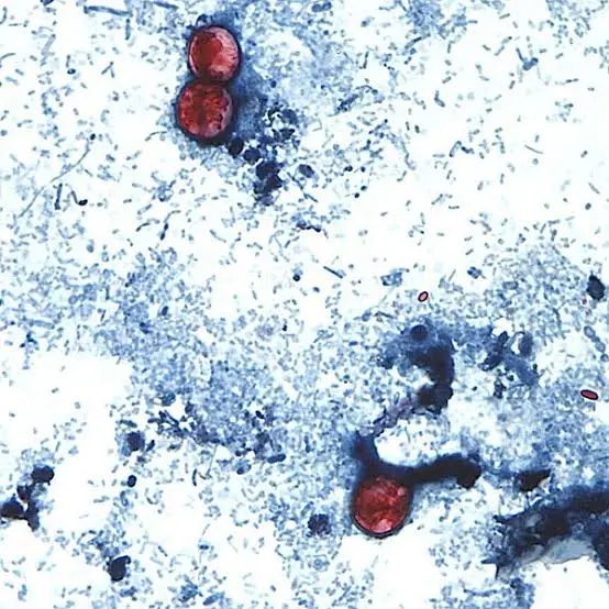 Fresh lettuce and vegetables as health officials investigate a Cyclospora parasite outbreak in Michigan.